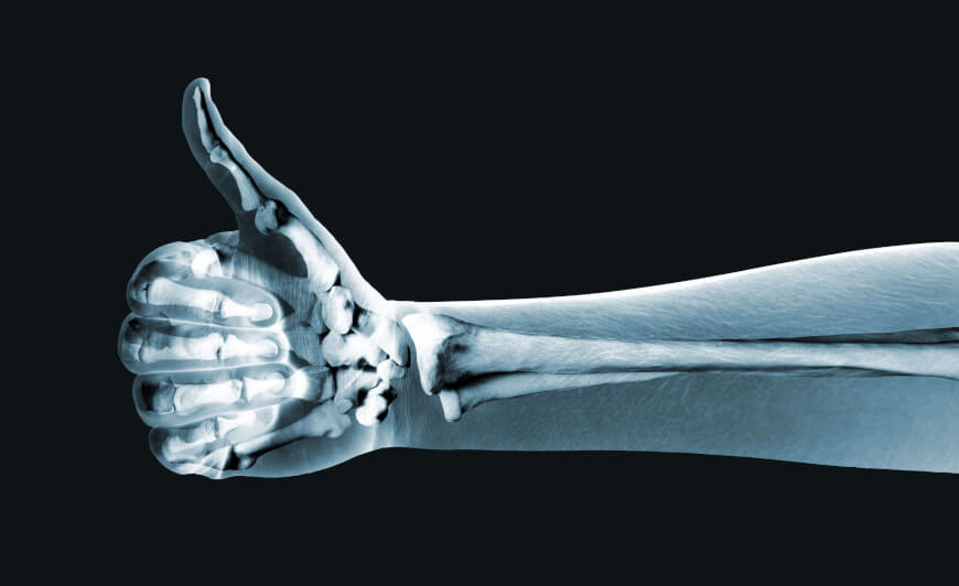 Interventional radiology australia