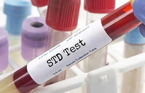 same day STD testing