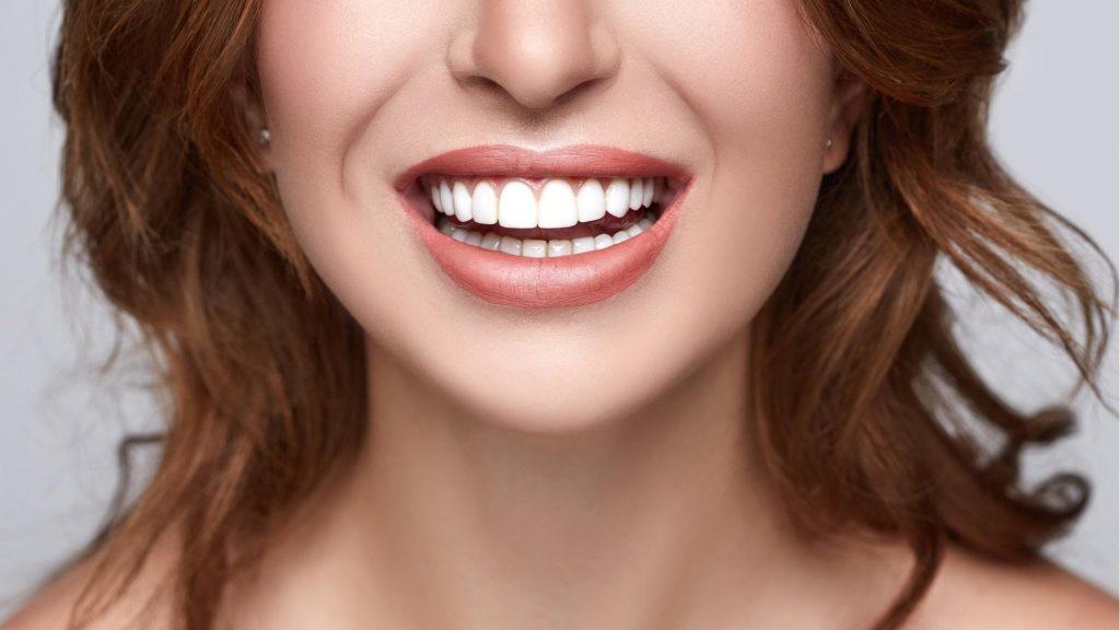perfect smile