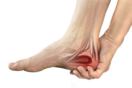 Heel Pain Treatment