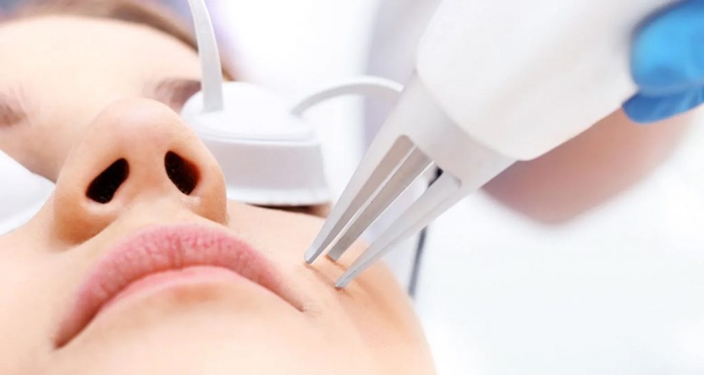 skin and cosmetic laser treatments in Camberwell