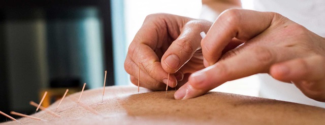 Amazing Effects of Acupuncture to Relieve Pain and Stress