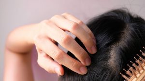 Hair Loss Problems In Men: Possible Causes And The Best Solution