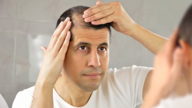 hair restoration