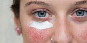The Importance of Purtier Stem Cells in a Wrinkle