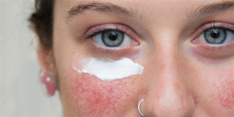 The Importance of Purtier Stem Cells in a Wrinkle
