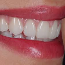 Estudi Dental Barcelona