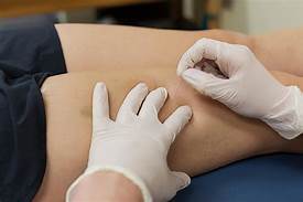 An Overview ON trigger point dry needling