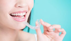 Clear Teeth Aligners