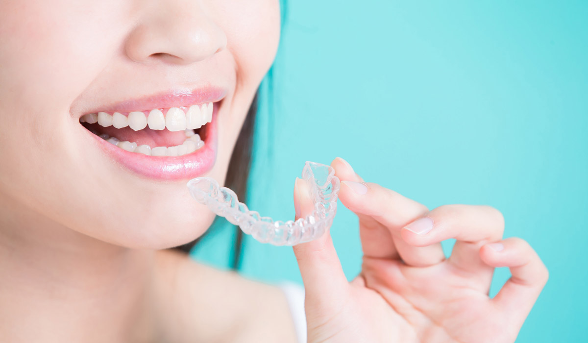 Clear Teeth Aligners