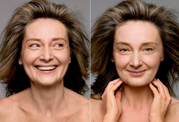 Treatments those are available to get rid of sagging issues