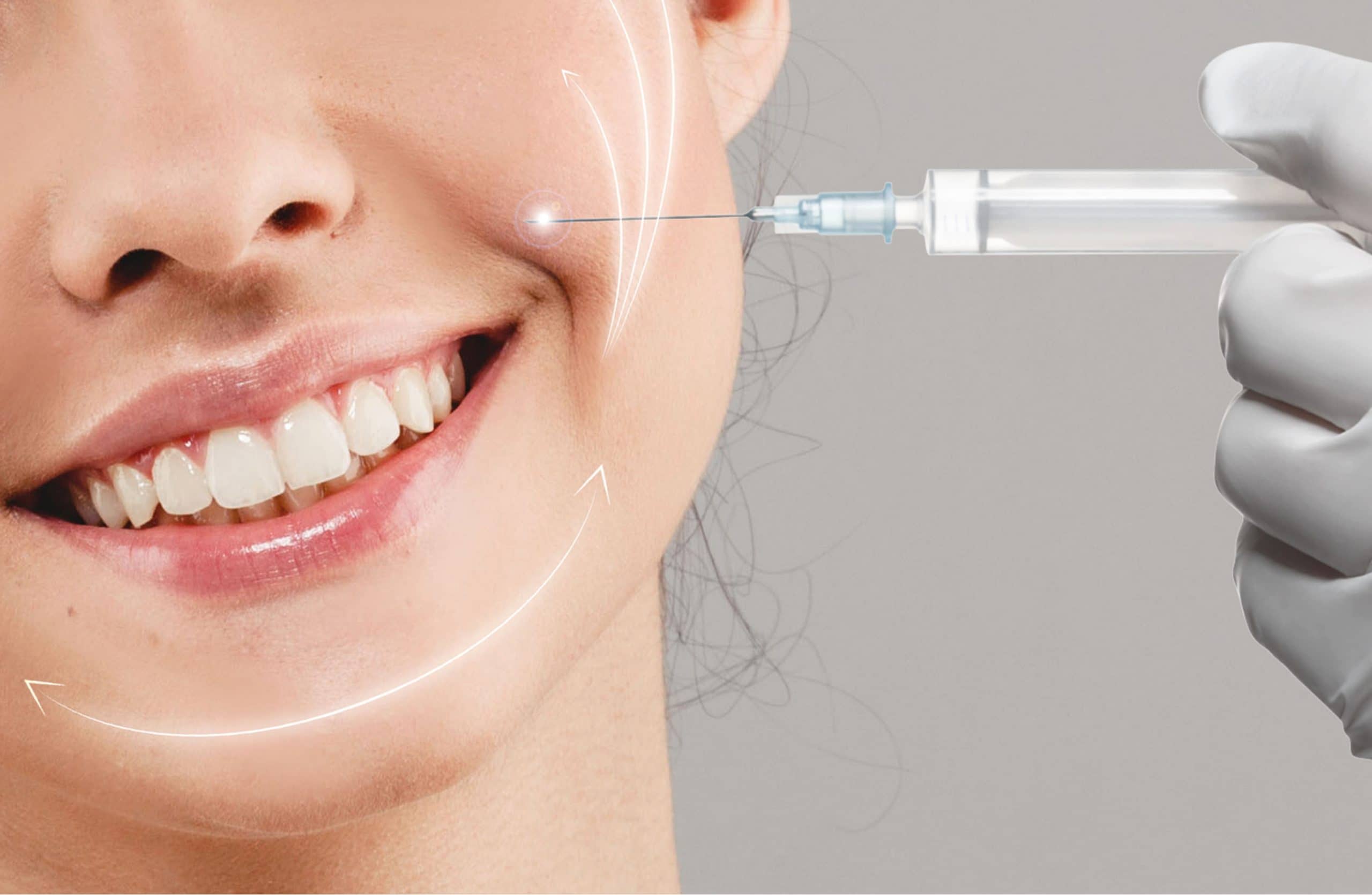 Restylane Mechanism